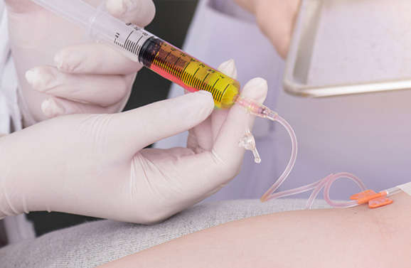 high-dose vitamin c iv therapy