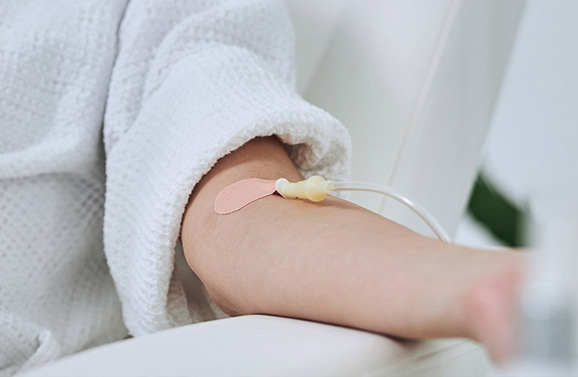 iv vitamin therapy