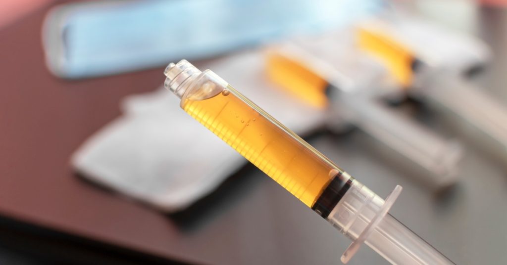 A plastic disposable syringe full of platelet-rich plasma.