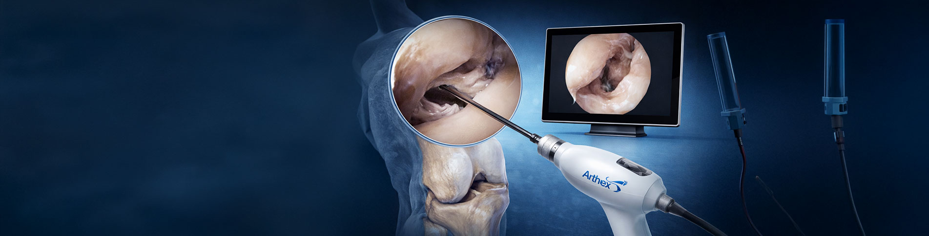 NanoScope™ Needle Arthroscopy