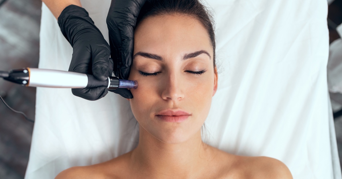 A person wearing black latex gloves is using a microneedling device on the face of a relaxed woman.