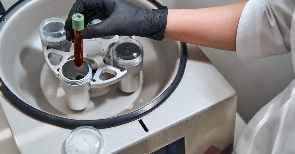 A person wearing black latex gloves is placing a vial of blood into a centrifuge machine.