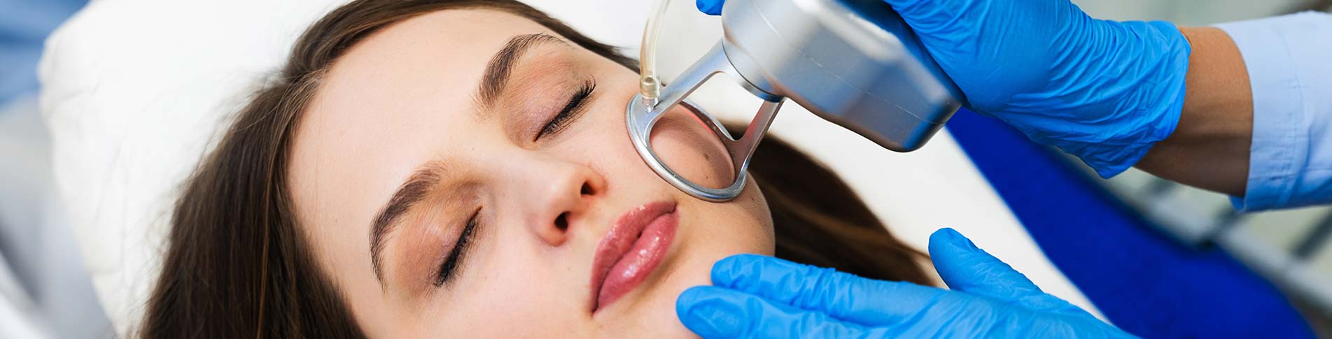 Ablative CO2 Laser Resurfacing