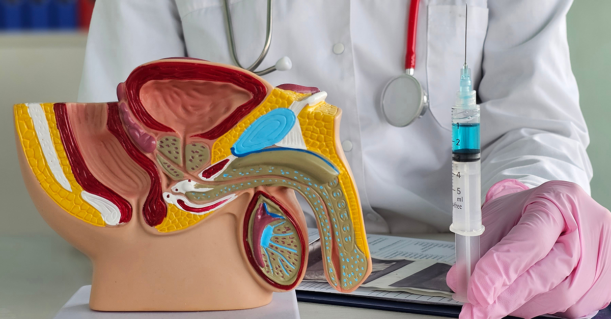 How Ozone Prostate Injections May Help Support Men’s Vitality and Comfort