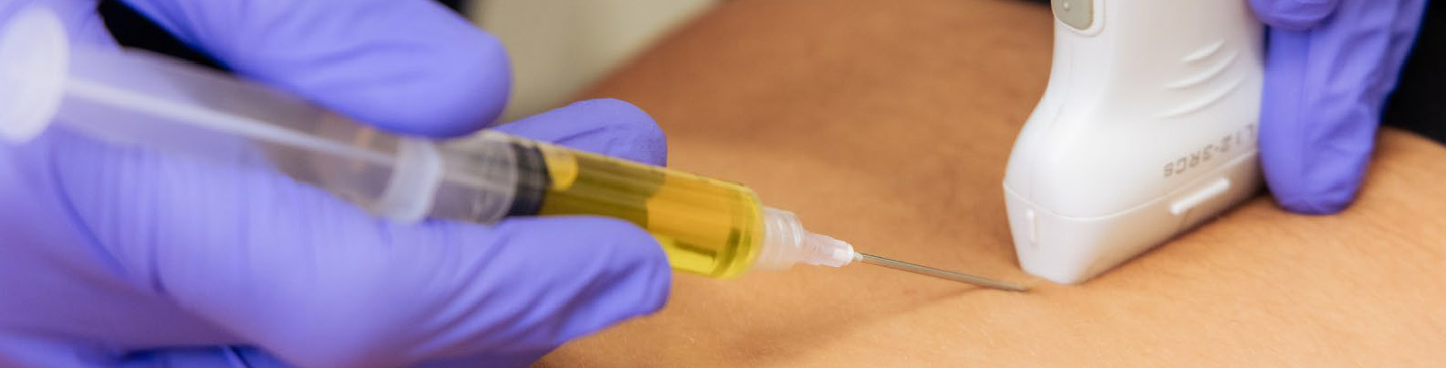 Full Body Regenerative Injection