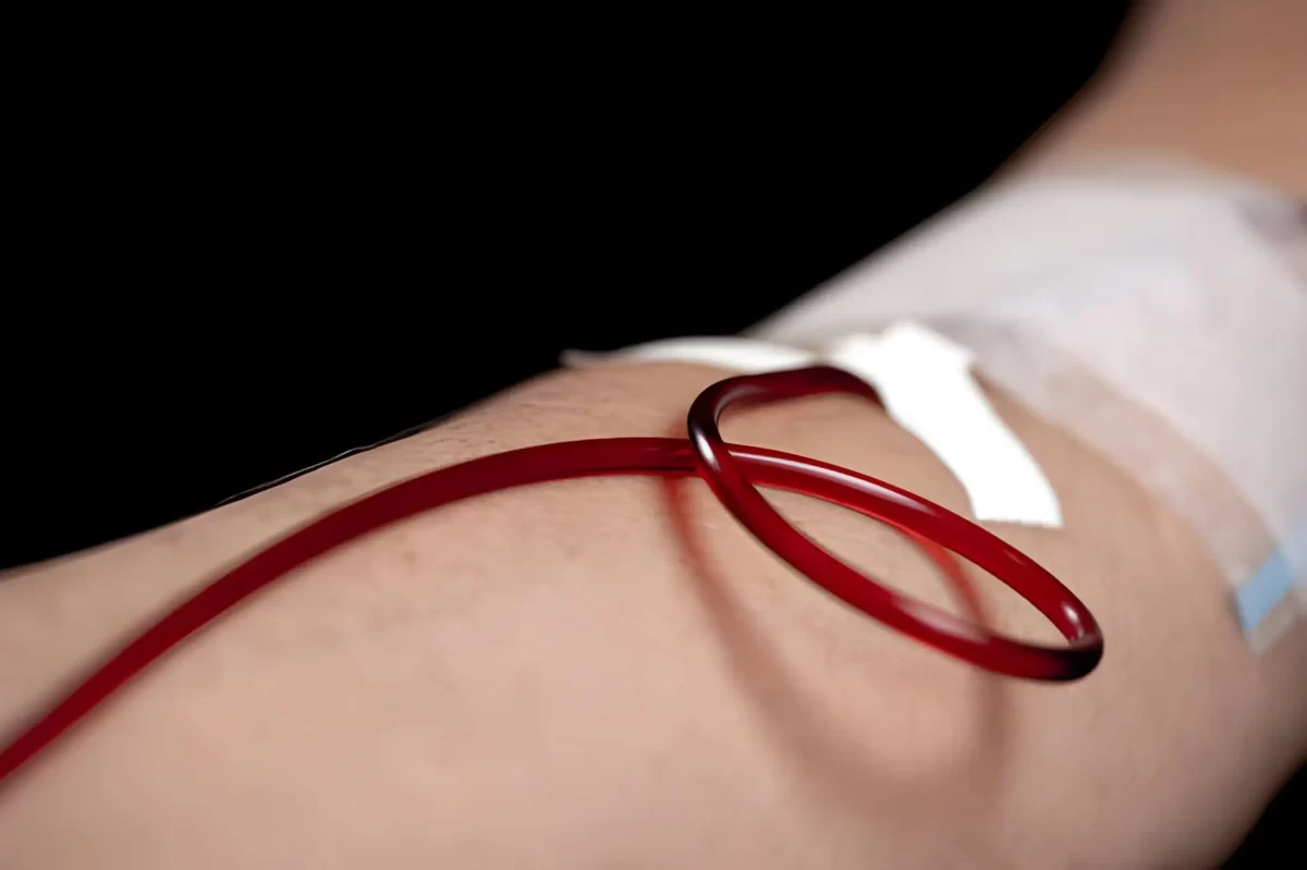 What a Century of Blood Filtration Taught Me About Judging a New Therapy