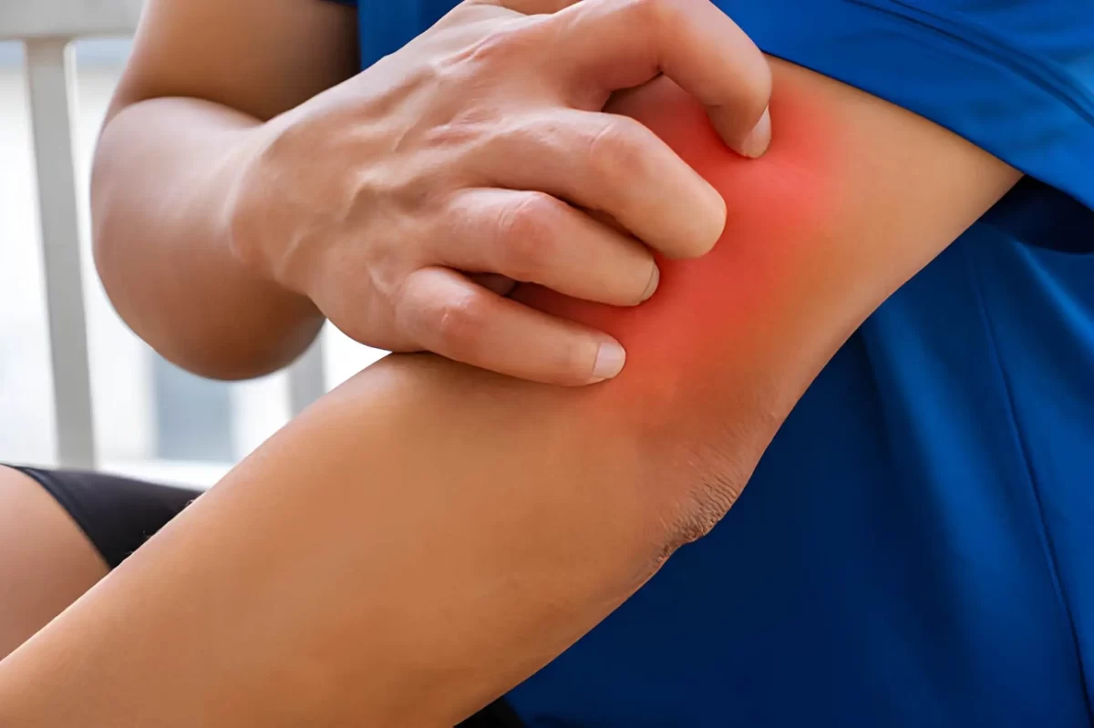 What I Tell Patients Whose Lyme Symptoms Never Went Away