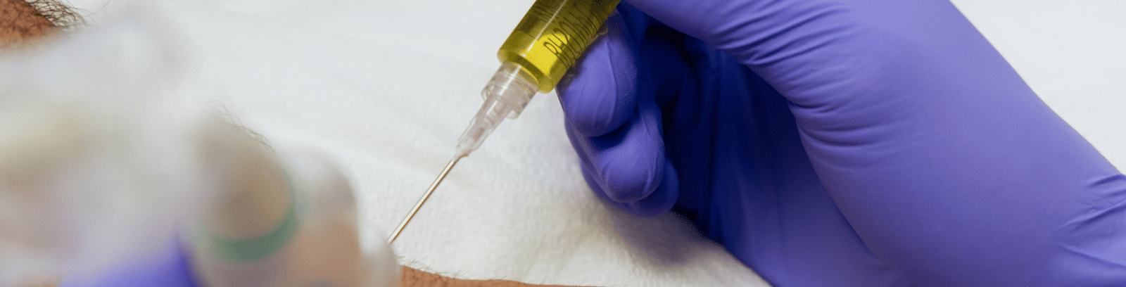 Stem Cell Therapy